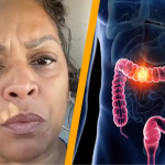 Woman diagnosed with stage 3 colon cancer shares 5 symptoms she overlooked